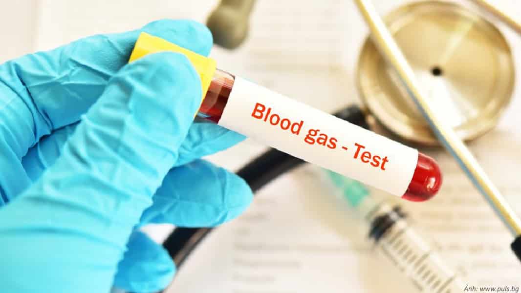 Phương pháp đo nồng độ oxy trong máu xâm lấn - Arterial blood gas